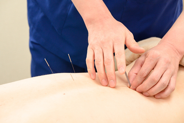 全身鍼灸