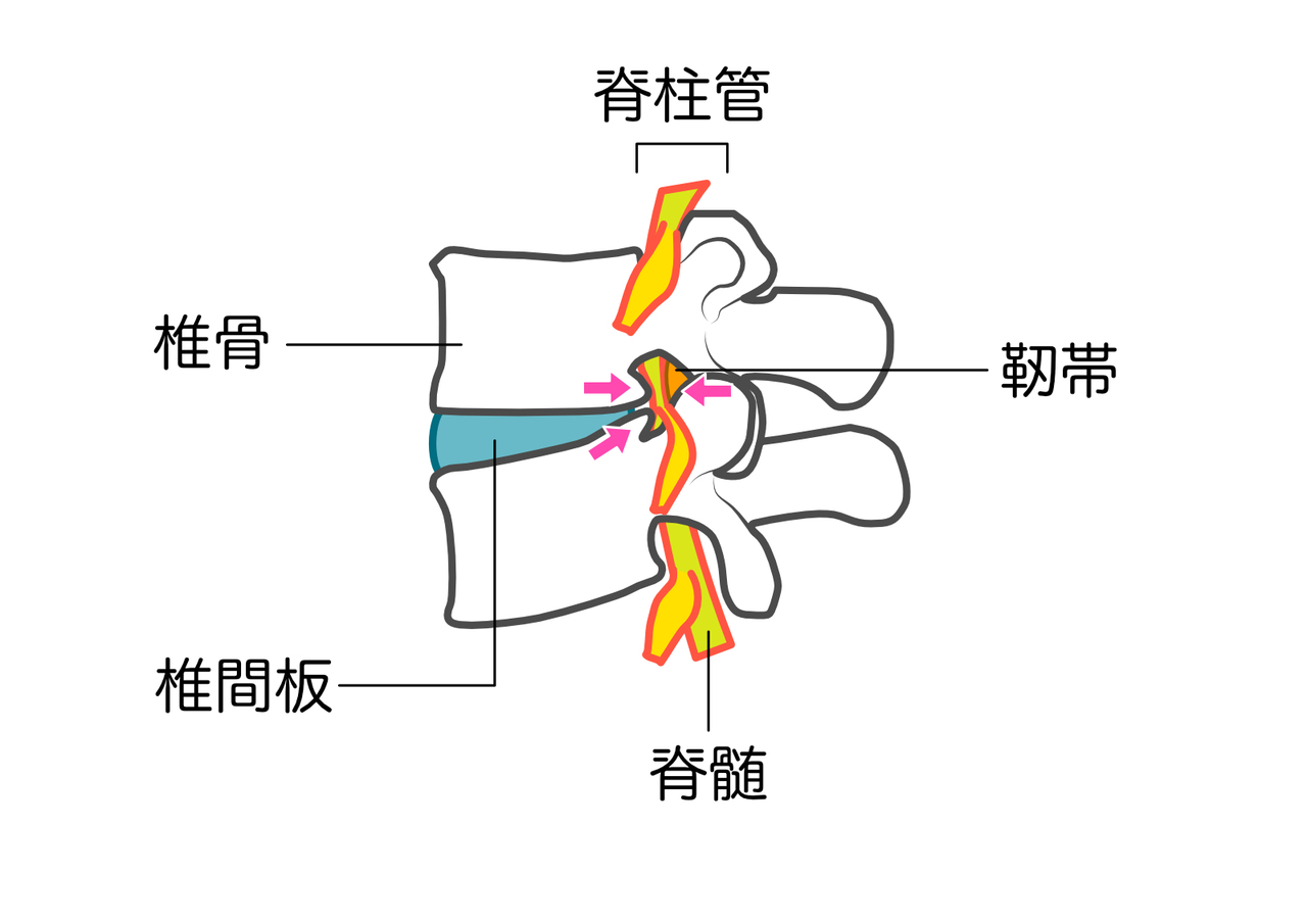 足が痺れている女性
