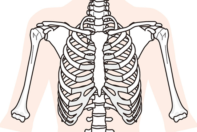 腰部分離すべり症イラスト